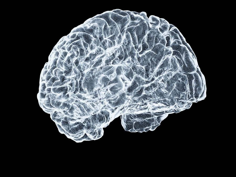 X-ray image of a human brain